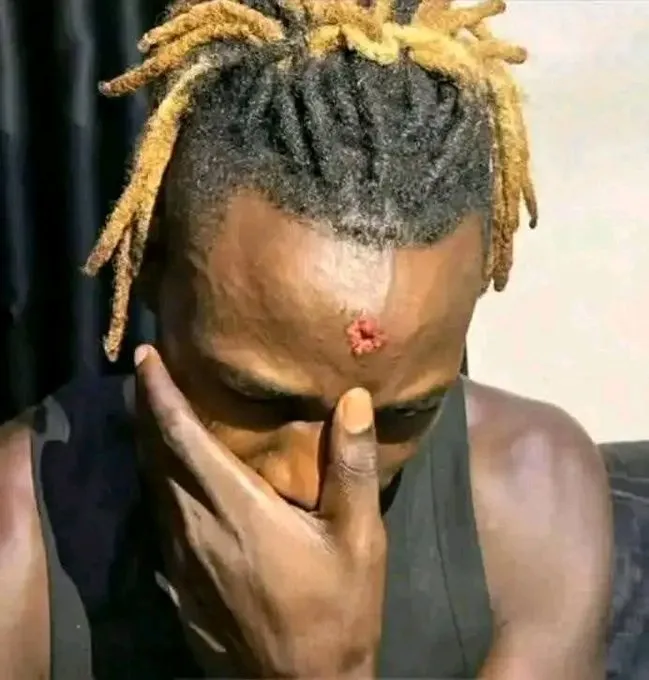 Alien Skin puts his shows on hold as he recovers from head injuries